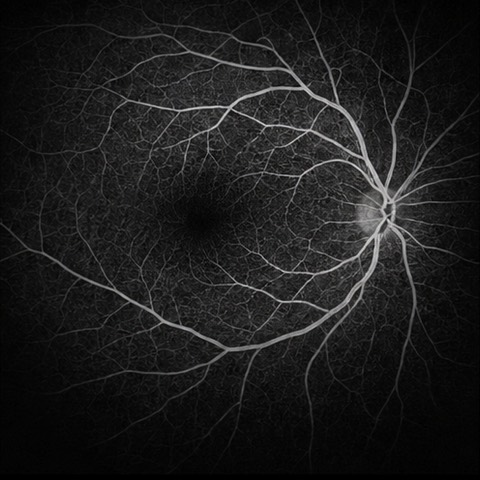 OS Angiography
