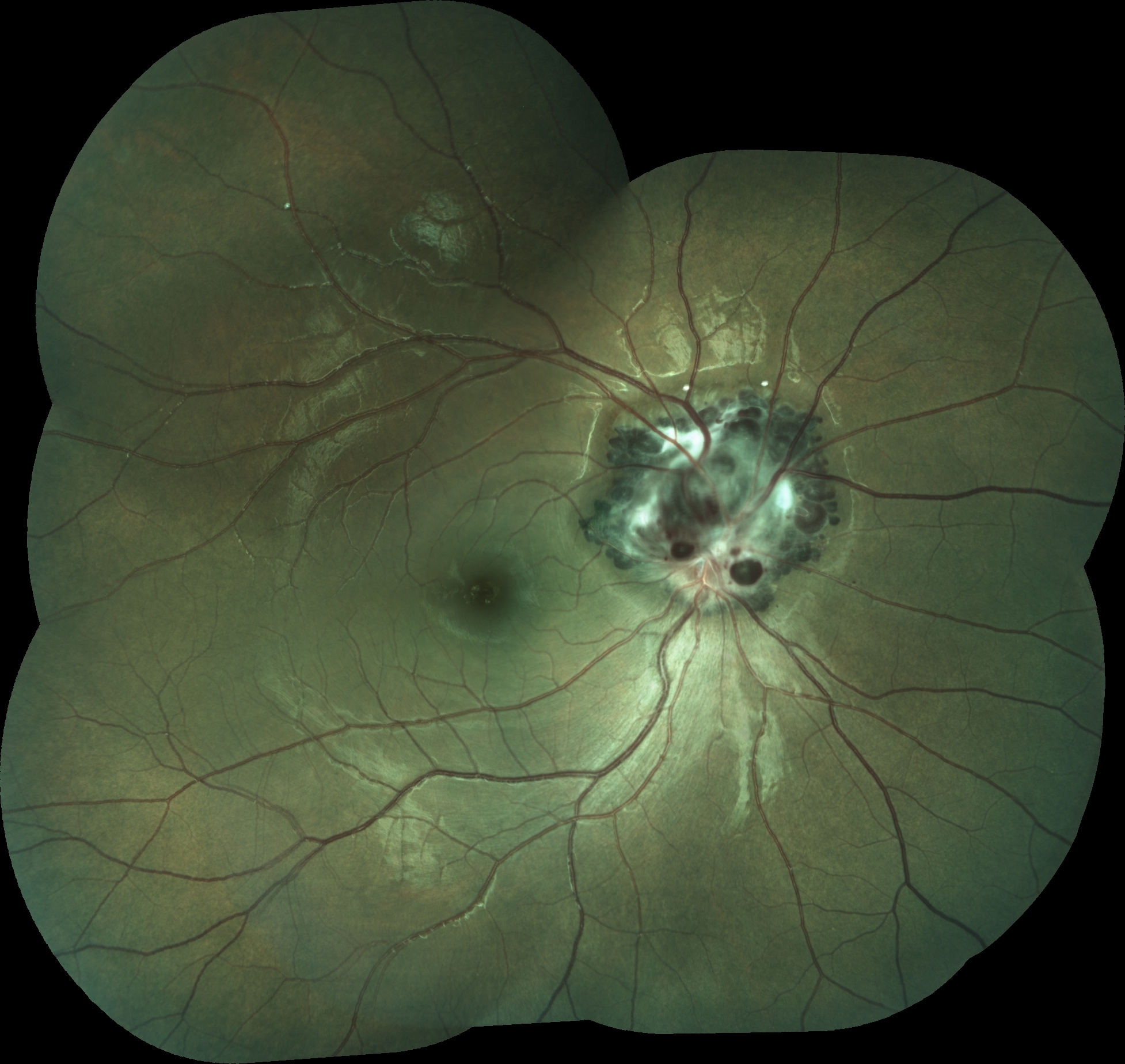 OD Ophthalmic Phot...